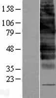 SLC2A9 / GLUT9 Protein (Over-Expression Lysate Myc-DDK (Flag))