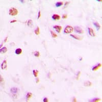 GATA4 Antibody (Internal)