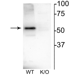 CHRNB4 Antibody
