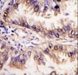 STK39 / SPAK Antibody (aa386-415)