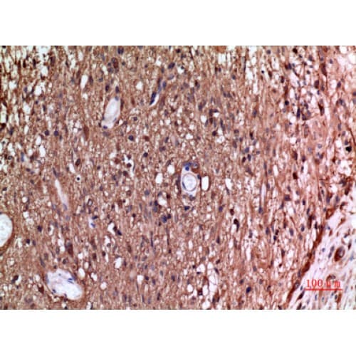 Polyclonal Rabbit anti-Human Alpha Tubulin Antibody (IHC, WB)