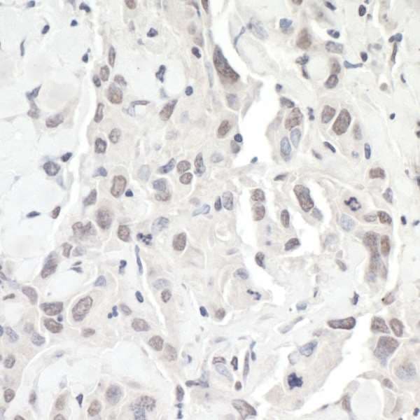 Polyclonal Rabbit anti-Human ZEB1 / AREB6 Antibody (aa1074-1124, IHC)