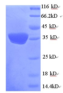 Human UCP1 / UCP-1 Protein (Recombinant His)