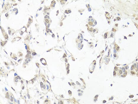 CASP3 / Caspase 3 Antibody