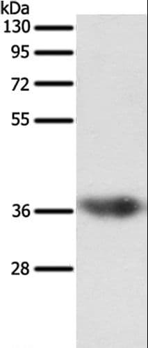 SULT1E1 / Sulfotransferase 1E1 Antibody