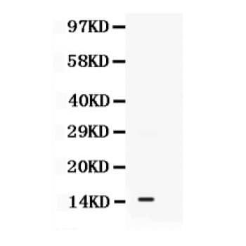 Calgizzarin / S100A11 Antibody (aa2-105)