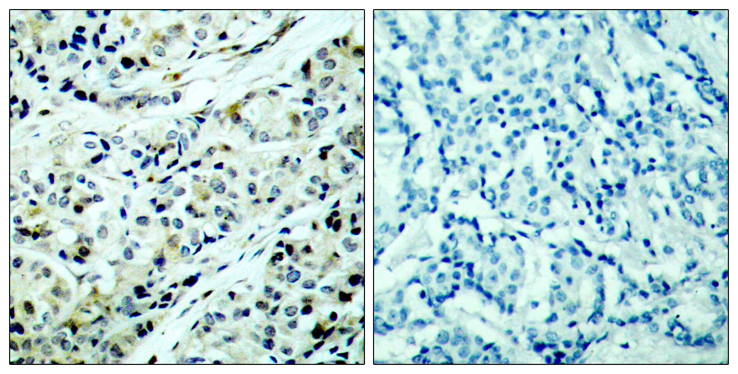 HDAC5 Antibody (phospho-Ser498)