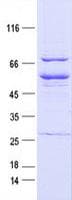 Human EPHB1 / EPH Receptor B1 Protein (Recombinant DDK,C-terminus)