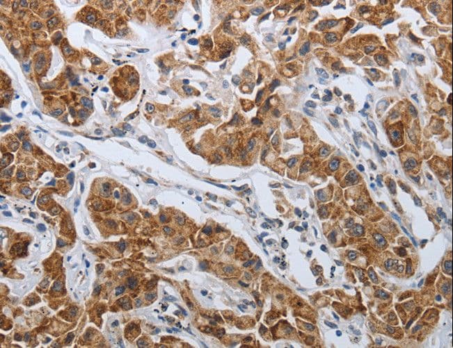 Polyclonal Rabbit anti-Human SPAG1 / TPIS Antibody (IHC, WB)
