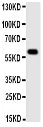 MAOA / Monoamine Oxidase Antibody (aa51-69)