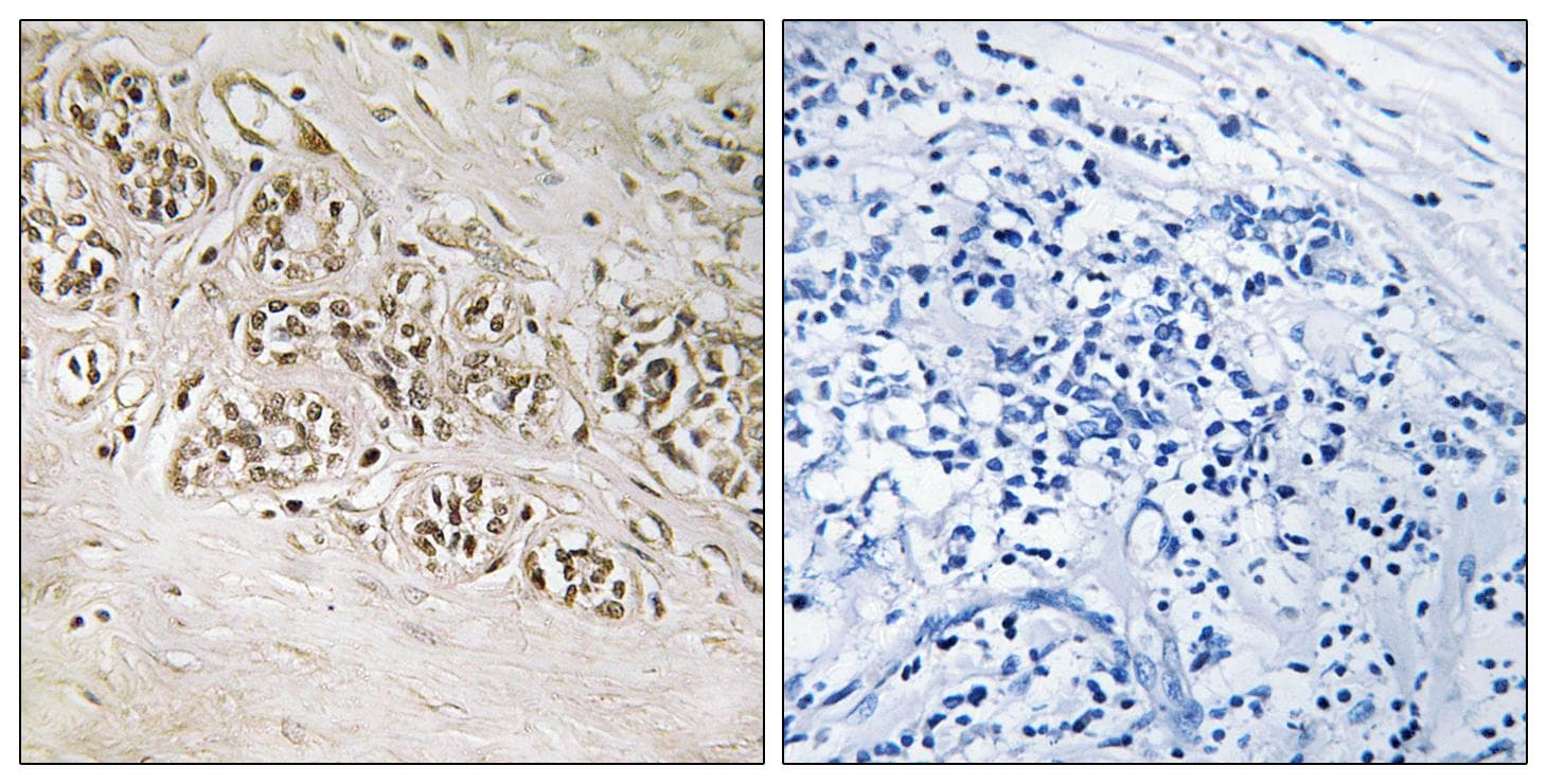 RAD54B Antibody
