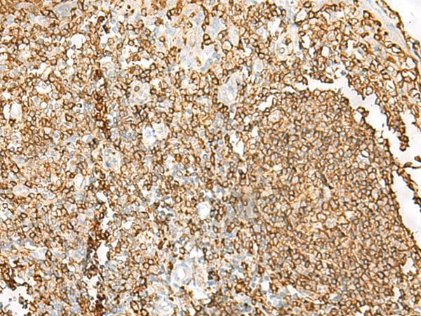 HLA-DRB1 Antibody
