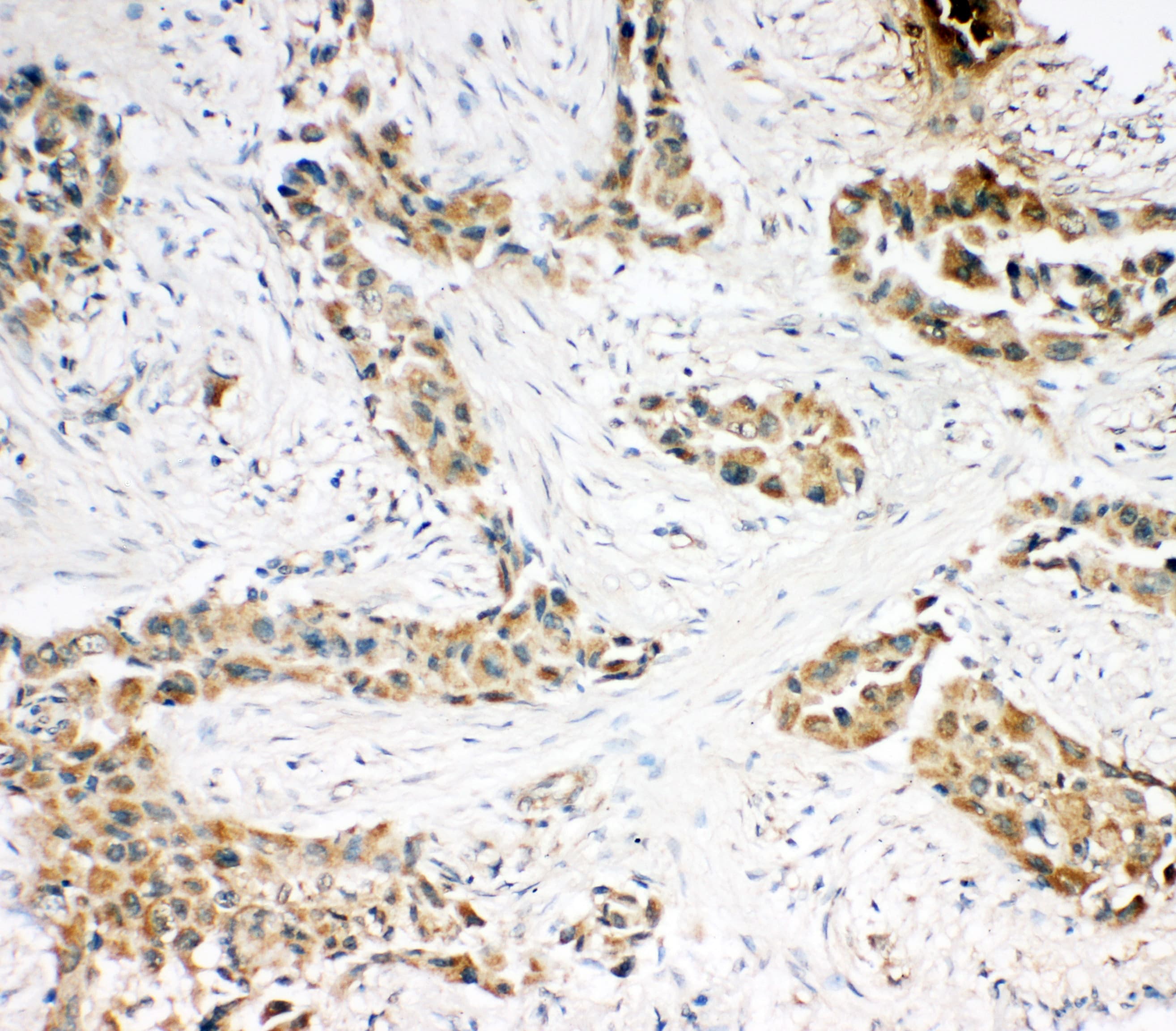 CASP3 / Caspase 3 Antibody (C-Terminus)
