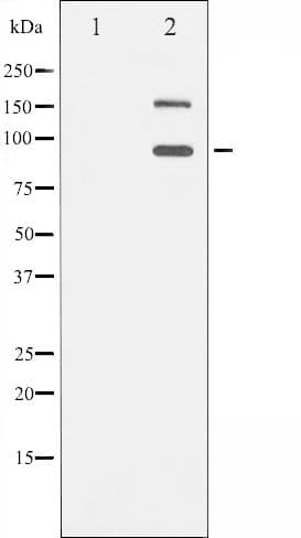 IGF1R / IGF1 Receptor Antibody (phospho-Tyr1165,pTyr1166)