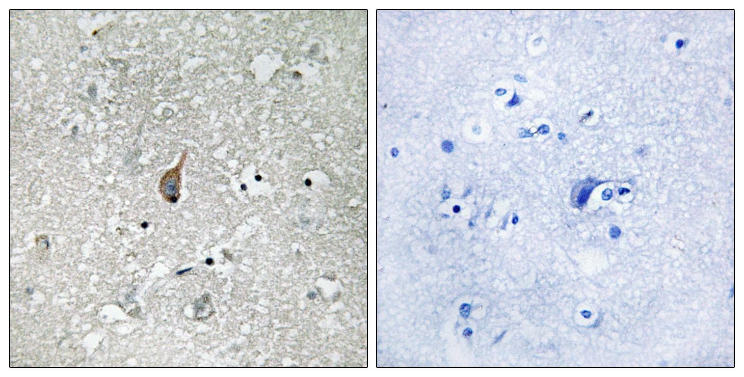 Polyclonal Rabbit anti-Human ANAPC1 / APC1 Antibody (phospho-Ser355, IHC)