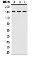 Polyclonal Rabbit anti-Human INPP5D / SHIP1 / SHIP Antibody (C-Terminus, WB)