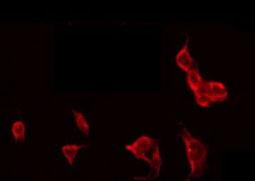 Polyclonal Rabbit anti-Human CD302 Antibody (IHC, IF, WB)