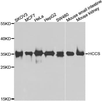 HCCS Antibody