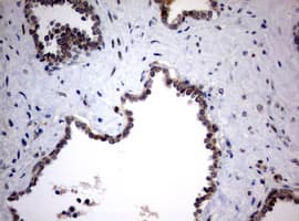 MKI67 / Ki67 Antibody (aa1160-1493, clone OTI5E6)