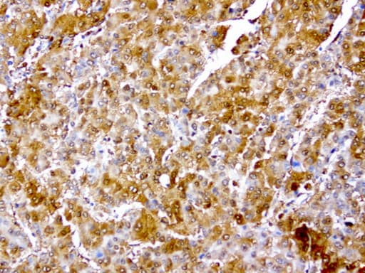 TP / Thymidine Phosphorylase Antibody (aa311-482, clone UMAB97)