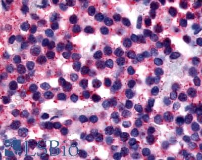 PathPlus™ CALCR / Calcitonin Receptor Antibody (N-Terminus)