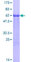 Human UROD Protein (Recombinant GST)