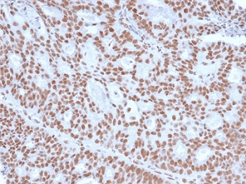 PR / Progesterone Receptor Antibody (clone PGR/2694, Azide-free, BSA-free)