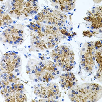 Polyclonal Rabbit anti-Human SSTR2 Antibody (IHC, WB)