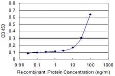 IHC-plus™ Monoclonal Mouse anti-Human PRKRA / PACT Antibody (clone 1B9-1A7, IHC, WB)