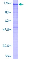 Human PHKA2 Protein (Recombinant GST)