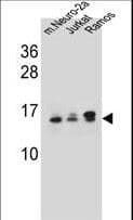 UBE2E2 / UBCH8 Antibody (aa16-43)