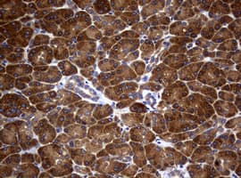 NME1 / NM23 Antibody (clone OTI6E9)