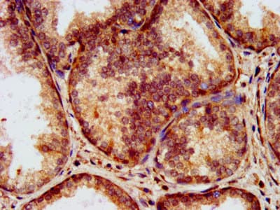 LAMA2 / Merosin Antibody