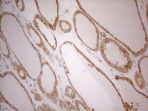 BCL2 / Bcl-2 Antibody (clone UMAB225)