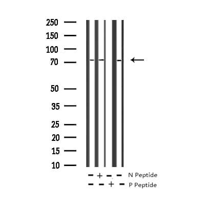 LIMK1 / LIMK Antibody (phospho-Thr508,pThr505)