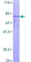 Human NOVA1 Protein (Recombinant GST)