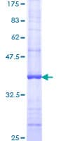 Human P2RY6 / P2Y6 Protein (Recombinant GST, N-terminus)