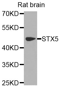 Polyclonal Rabbit anti-Human STX5 / Syntaxin 5 Antibody (WB)