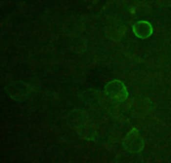 DYKDDDDK Tag Antibody