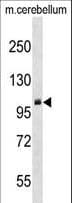 Polyclonal Rabbit anti-Human PRMT9 / PRMT10 Antibody (aa39-68, WB)