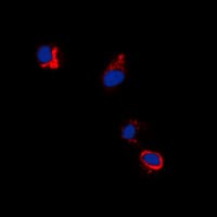 Polyclonal Rabbit anti-Human EPH Receptor B1+B2 Antibody (phospho-Tyr594/Tyr604, IF, WB)