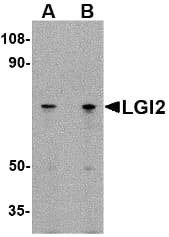 LGI2 Antibody