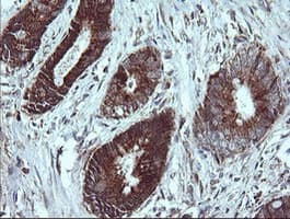 NDUFB9 Antibody (clone OTI3A1)