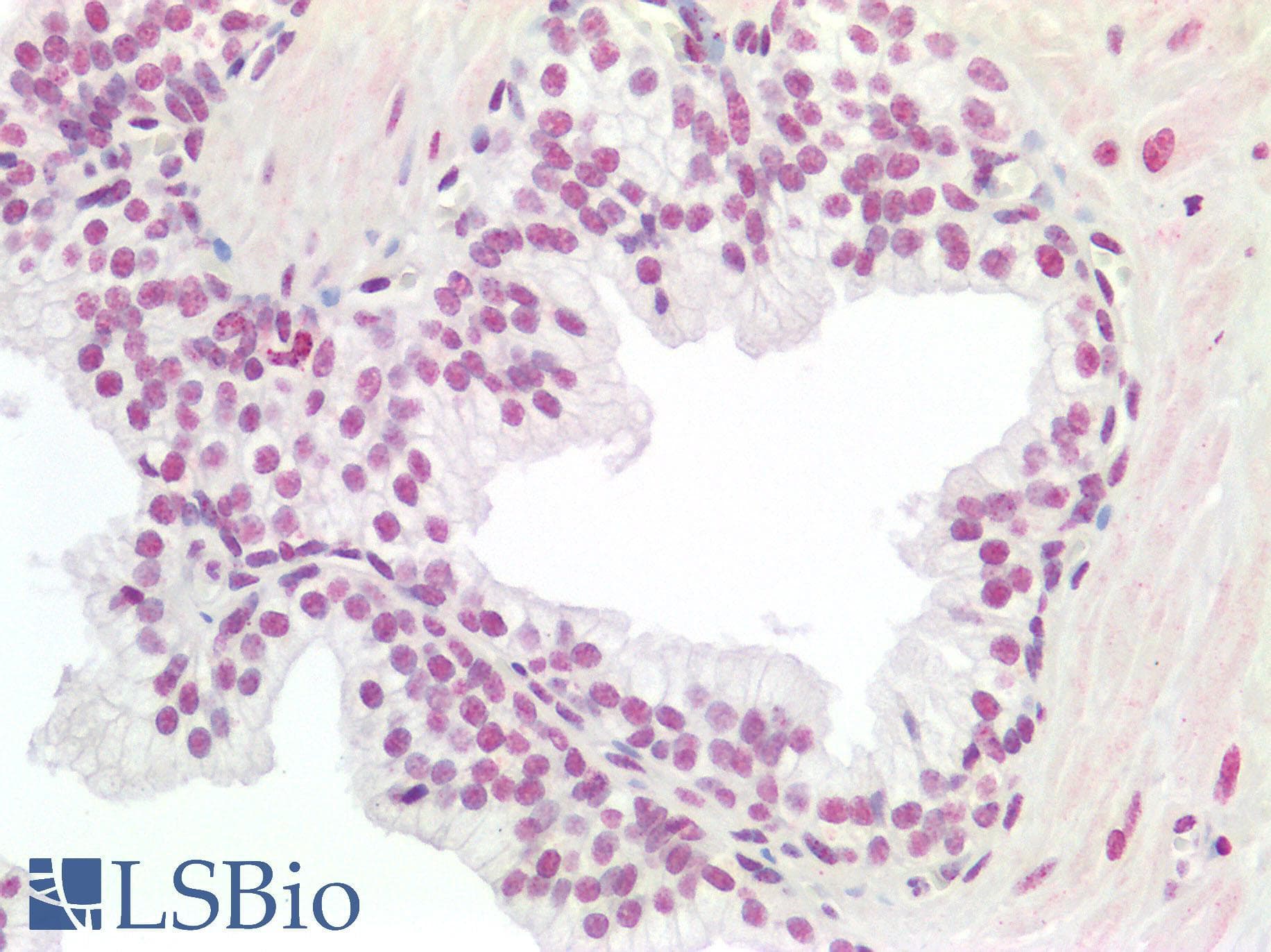 Monoclonal Mouse anti-Human HOXA9 Antibody (clone 2A11-2D2, IHC, IF, WB)