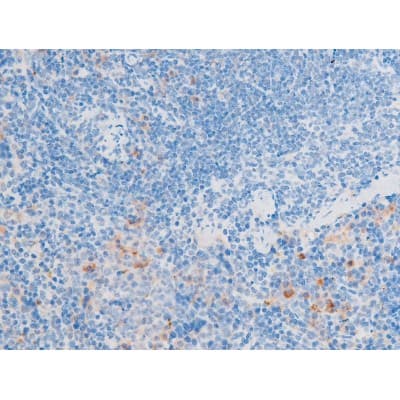LIMK1 / LIMK Antibody (phospho-Thr508)