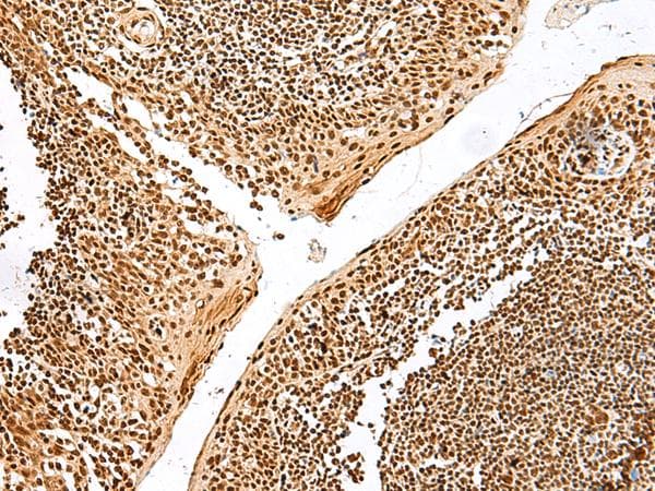 GRSF1 Antibody