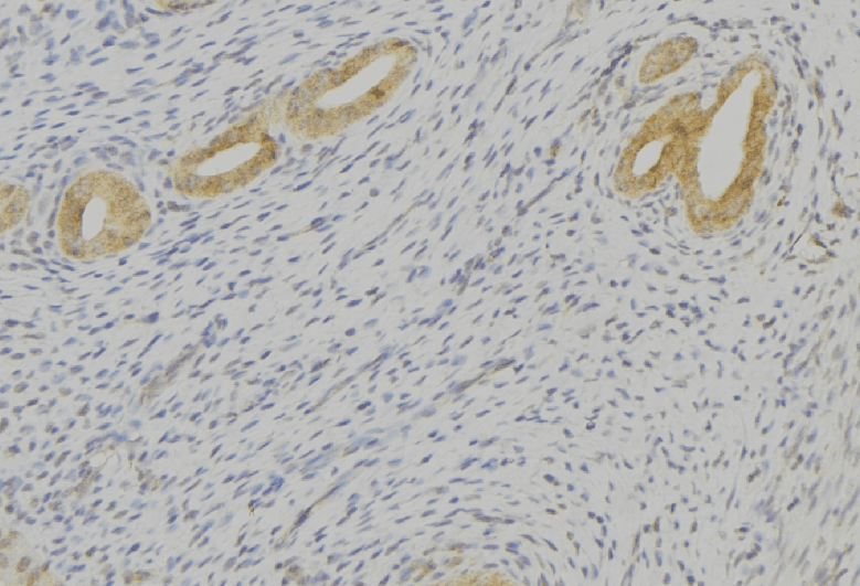 TAC1 Antibody