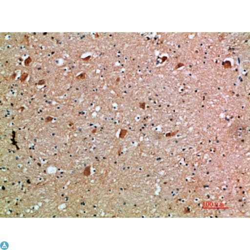 Polyclonal Rabbit anti-Human AcPL / IL18RAP Antibody (IHC)