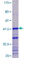 Human DDX17 Protein (Recombinant GST)
