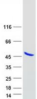 Human ANKRD2 Protein (Recombinant Myc-DDK (Flag))